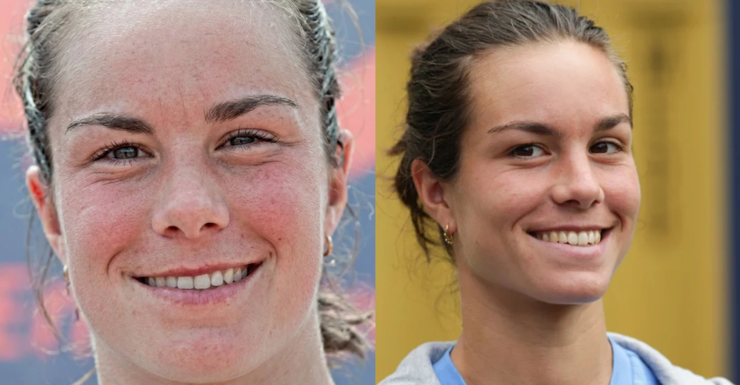 loïs boisson before and after